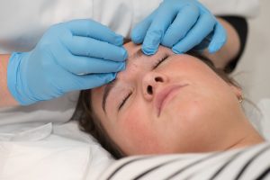 Acne behandeling DermaCentrum Apeldoorn
